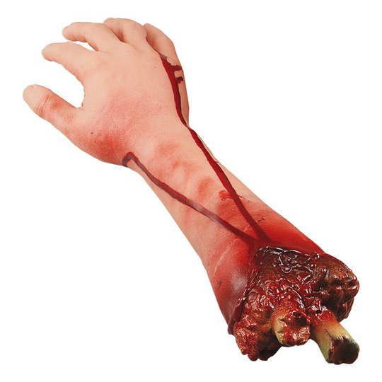 Avhuggen Arm